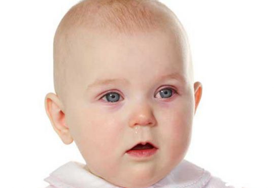 علت و درمان عفونت چشم در کودکان