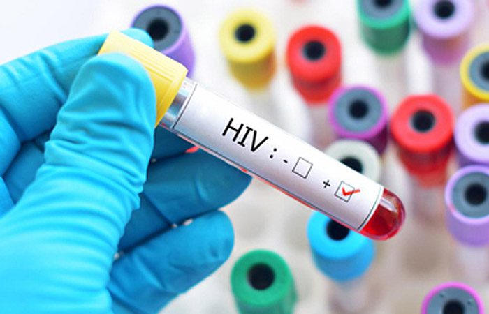 دانستنی‌هایی درباره اچ‌آی‌وی