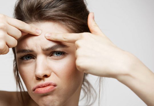 با این 7 راه از جوش زدن صورت‌تان جلوگیری کنید.