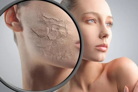 روش های خانگی برای از بین بردن ترک های پوستی 2