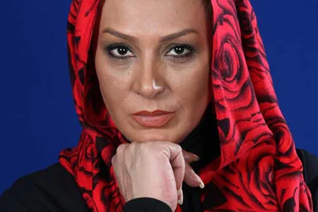 نسرین مقانلو سفیر بچه های بیماری پروانه ‌EB 2