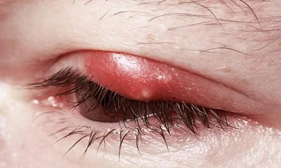 eyelash-shallazion1-1