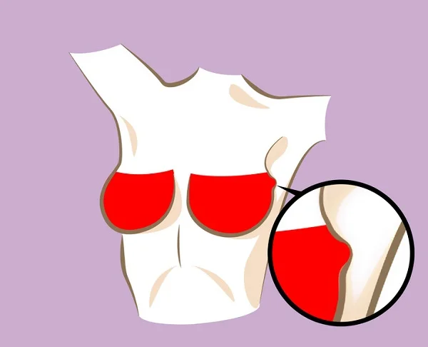 کدام تغییرات پستان ها طبیعی و کدام خطرناک هستند؟
