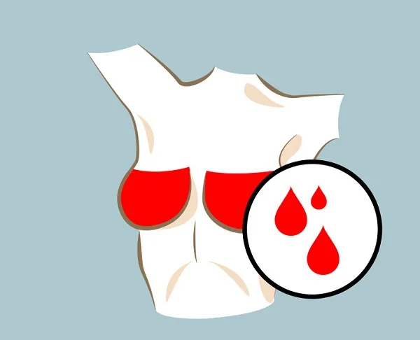 کدام تغییرات پستان ها طبیعی و کدام خطرناک هستند؟
