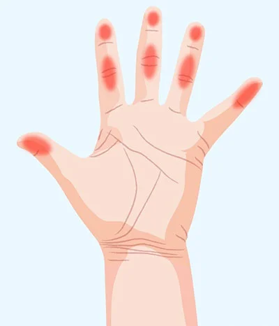 رابطه دست با سلامت بدن