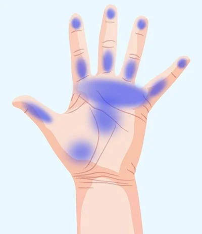 رابطه دست با سلامت بدن