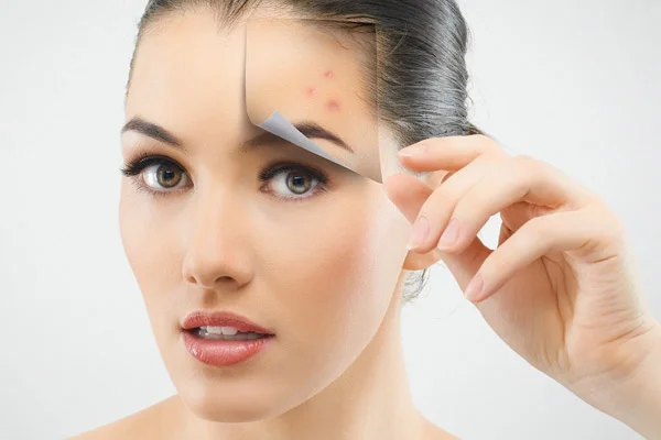 چه کنیم که جوش نزنیم؟
